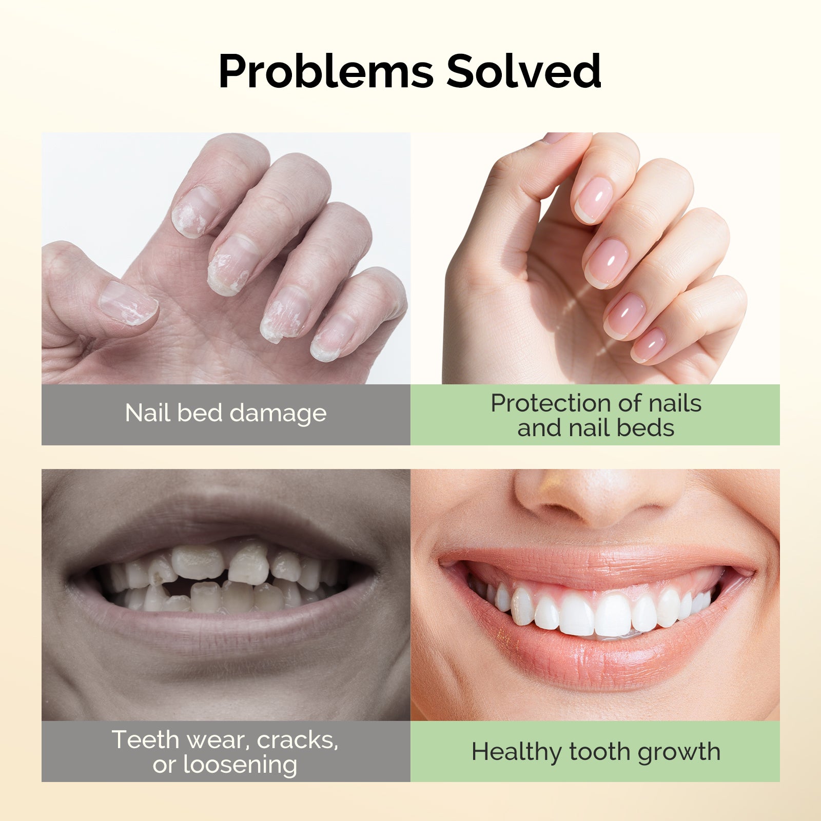 Nail Biting Treatment 15ml