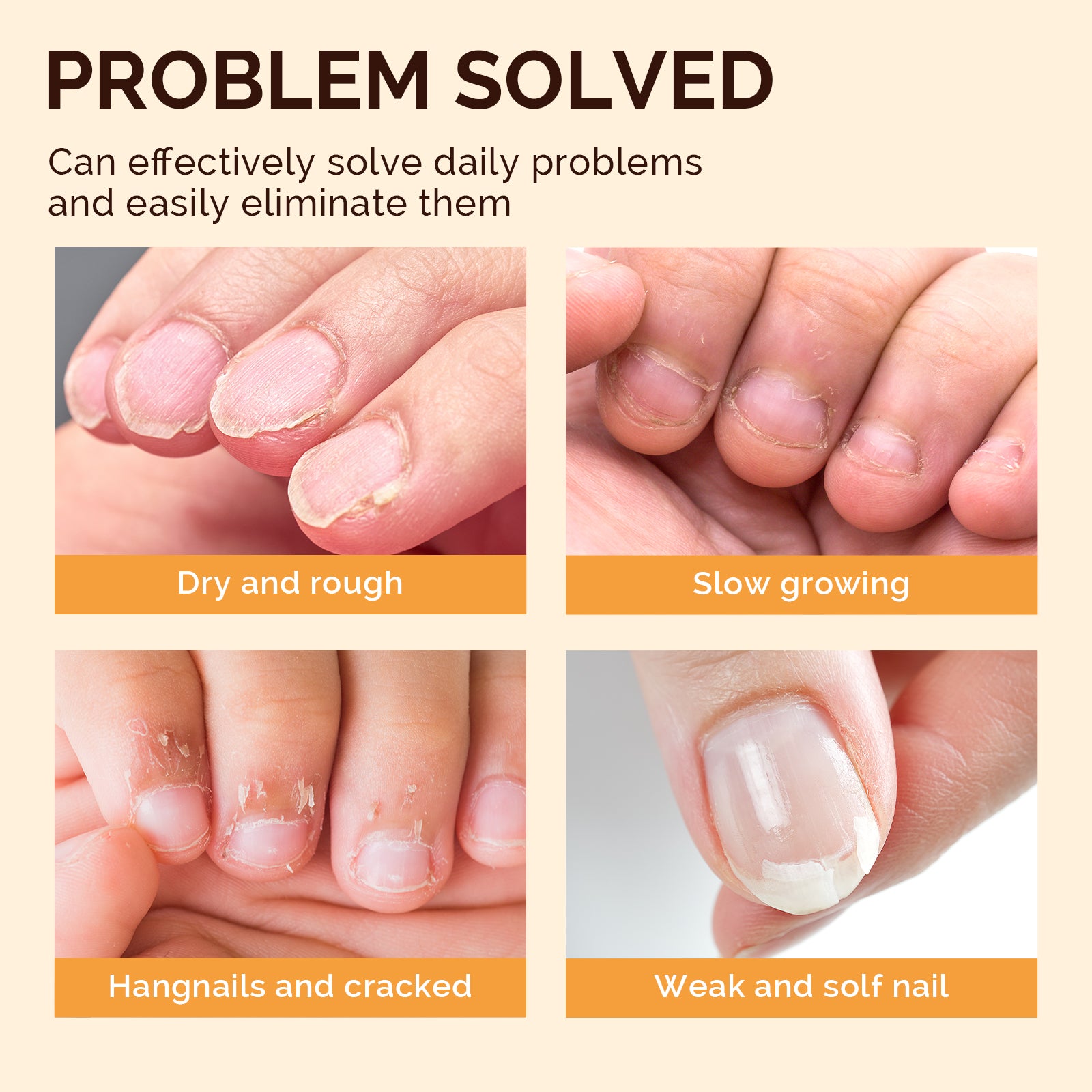 TPO-Free Cuticle Oil Pen Set