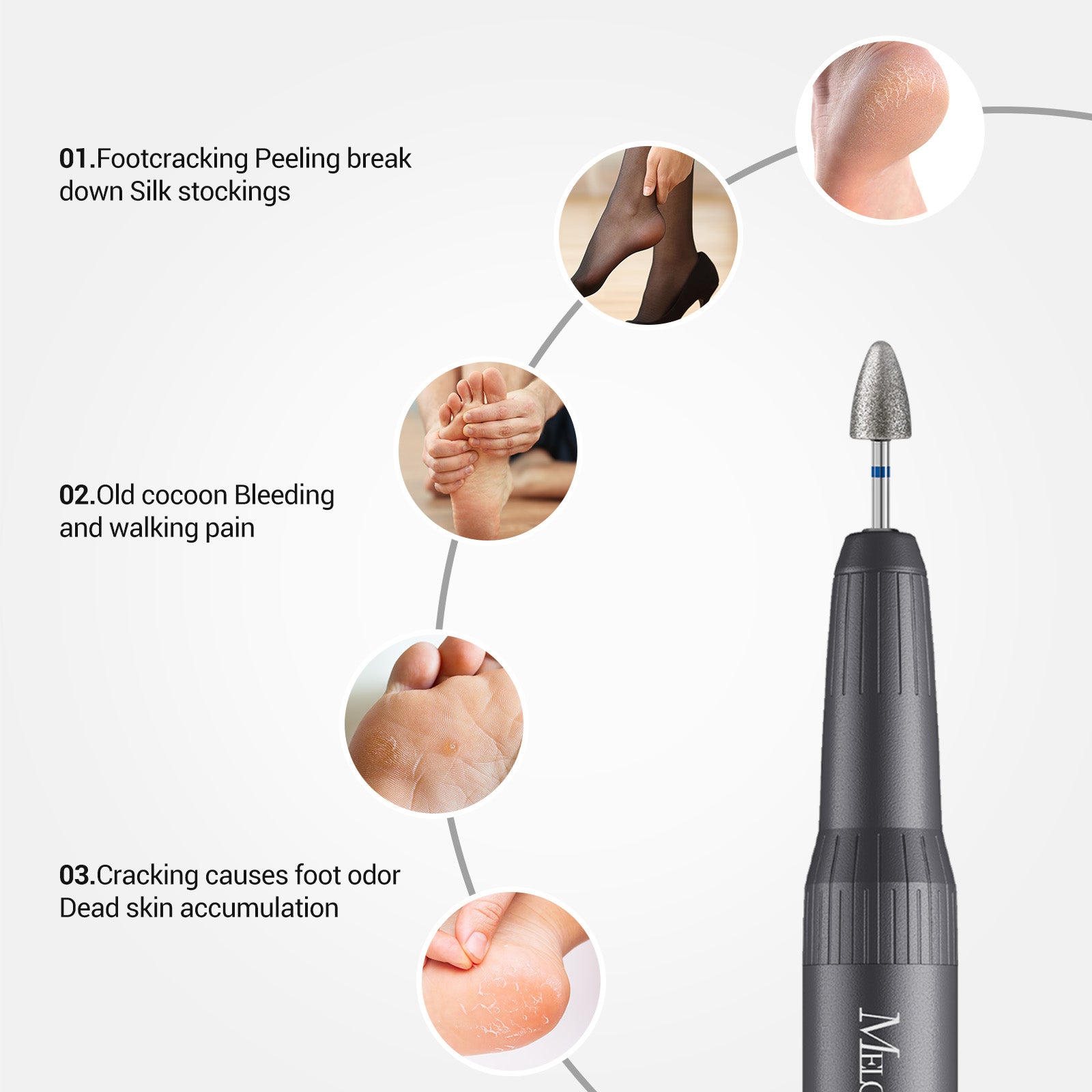 3Pcs 8mm Diamond Pedicure Cone Drill Bits Set