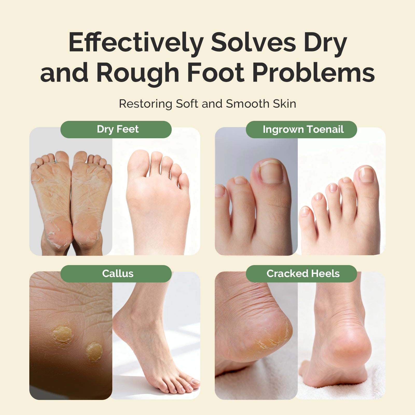 Tea Tree Oil Foot Soak with Sea Salt