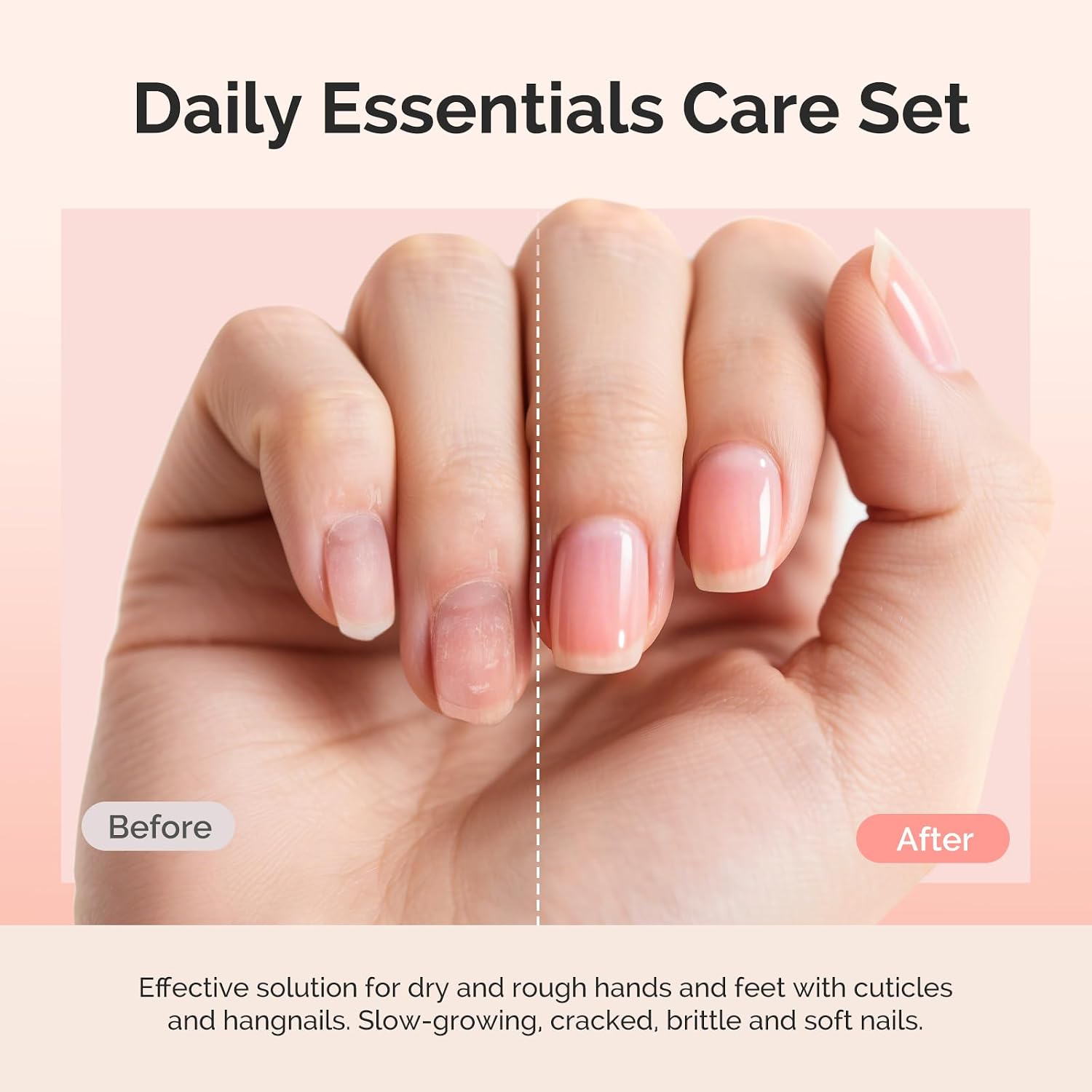Cuticle Remover Kit