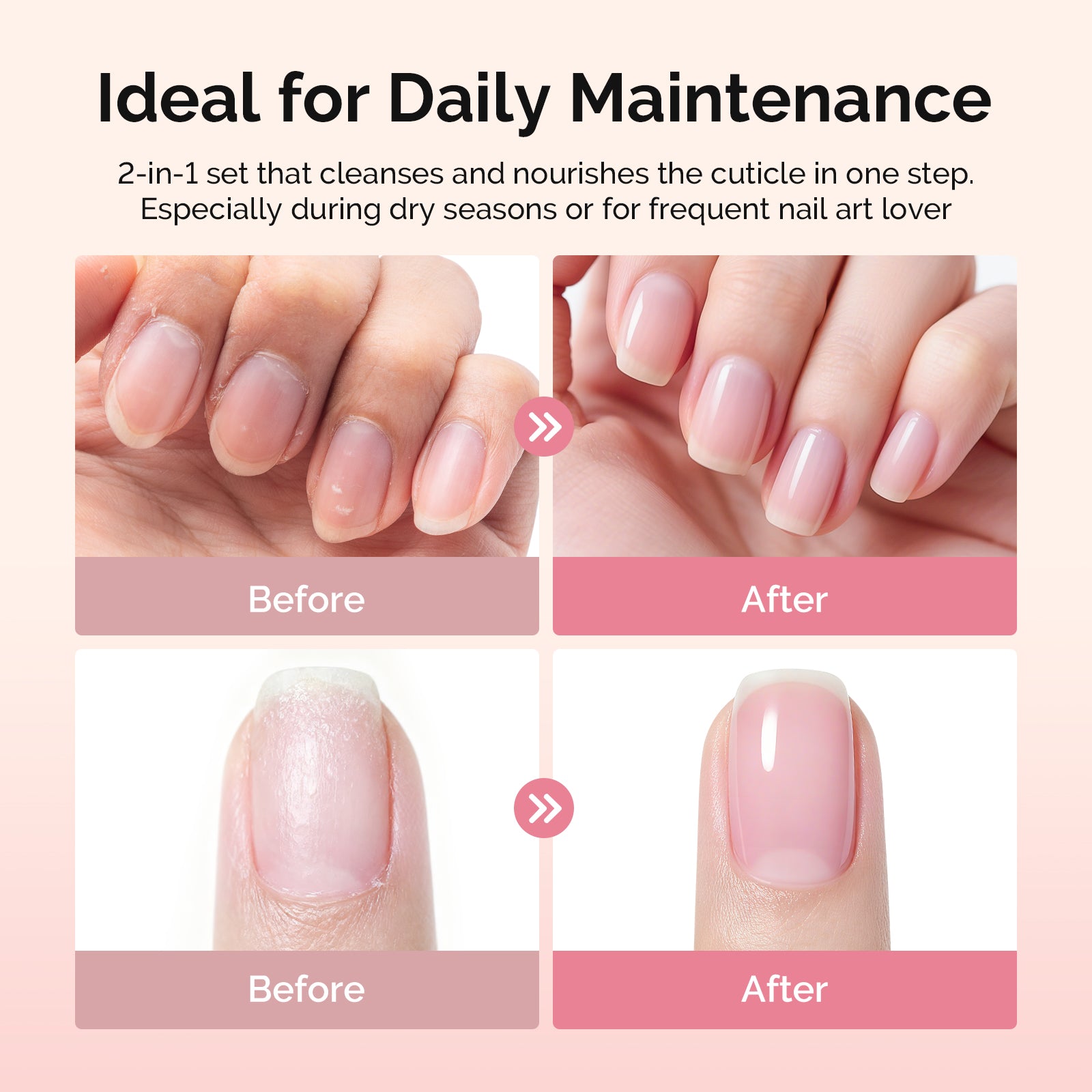 Cuticle Remover Kit
