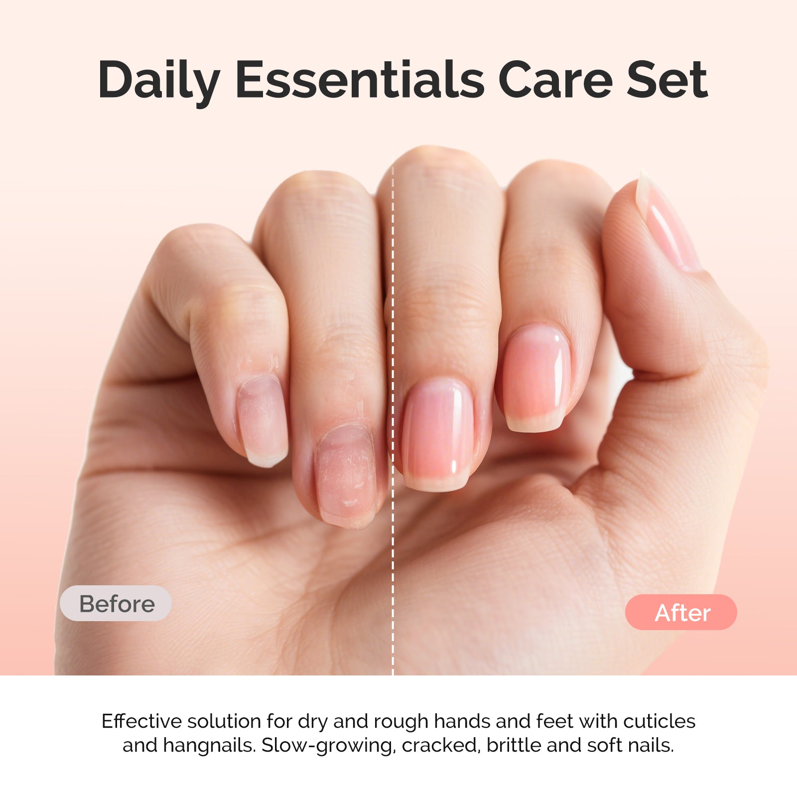 Cuticle Care Kit 25ml - Cuticle Oil and Cuticle Remover